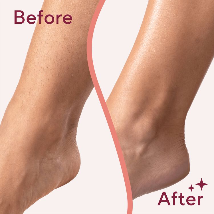Flawless Legs Hair Remover